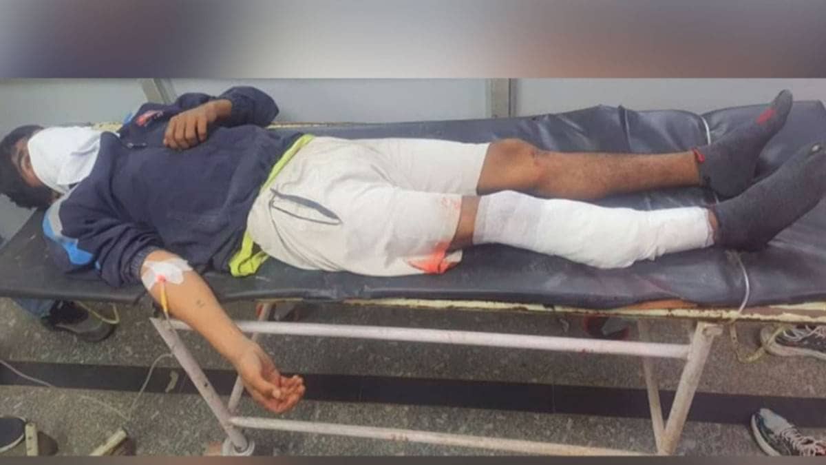 Delhi Police Arrest Notorious Chippi-Jatheri Gang Member After Encounter in Dwarka